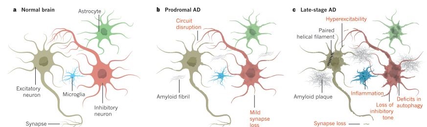 Road to restoring neural circuits for the treatment of Alzheimer's disease
